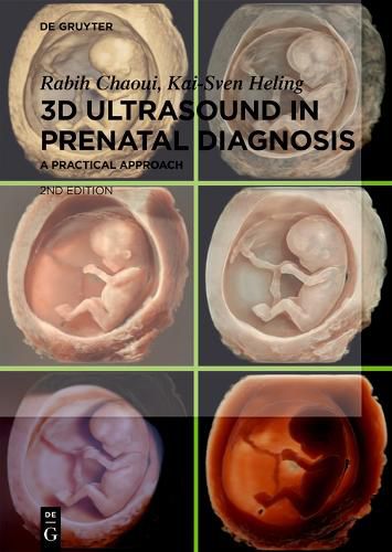Cover image for 3D Ultrasound in Prenatal Diagnosis