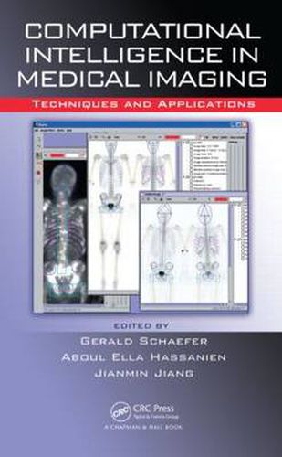 Cover image for Computational Intelligence in Medical Imaging: Techniques and Applications