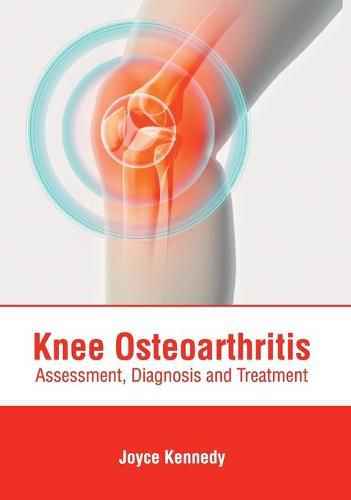 Cover image for Knee Osteoarthritis: Assessment, Diagnosis and Treatment