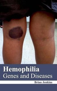 Cover image for Hemophilia: Genes and Diseases