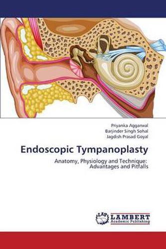 Cover image for Endoscopic Tympanoplasty