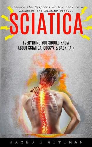 Cover image for Sciatica: Everything You Should Know About Sciatica, Coccyx & Back Pain (Reduce The Symptoms Of Low Back Pain, Sciatica And Bulging Disc)