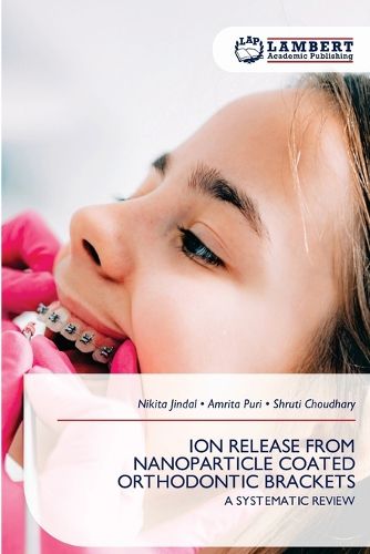 Cover image for Ion Release from Nanoparticle Coated Orthodontic Brackets