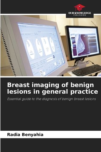 Cover image for Breast imaging of benign lesions in general practice