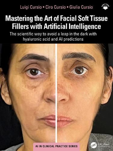 Cover image for Mastering the Art of Facial Soft Tissue Fillers with Artificial Intelligence