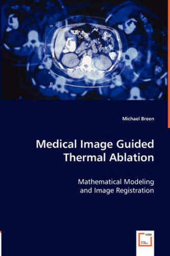 Cover image for Medical Image Guided Thermal Ablation