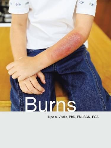 Cover image for Burns