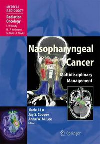 Cover image for Nasopharyngeal Cancer: Multidisciplinary Management