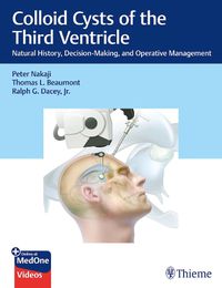 Cover image for Colloid Cysts of the Third Ventricle