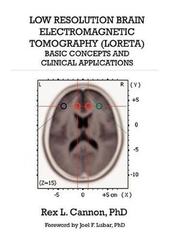 Cover image for Low Resolution Brain Electromagnetic Tomography (LORETA): Basic Concepts and Clinical Applications