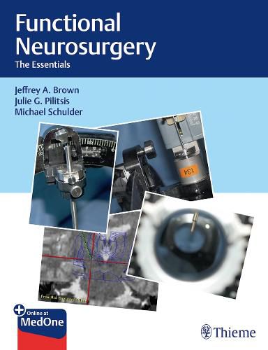 Cover image for Functional Neurosurgery: The Essentials