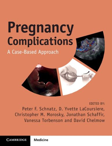 Cover image for Pregnancy Complications