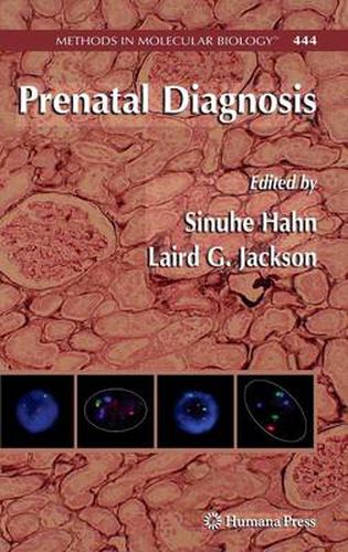 Cover image for Prenatal Diagnosis