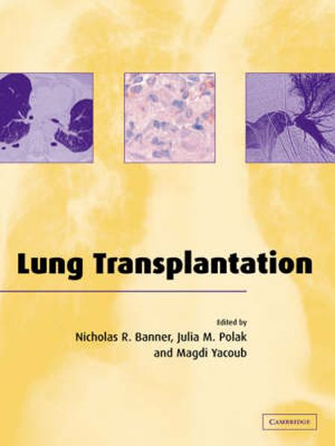Cover image for Lung Transplantation