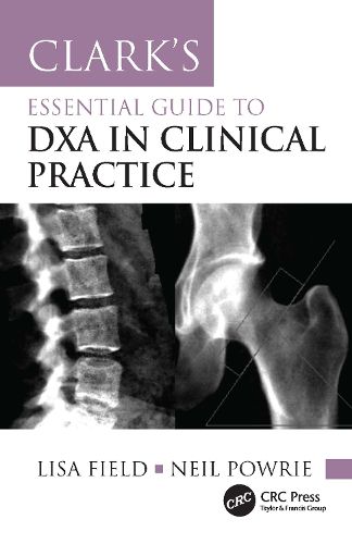 Cover image for Clark's Essential Guide to DXA in Clinical Practice