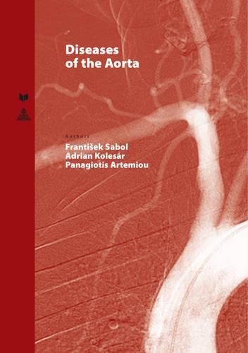 Cover image for Diseases of the Aorta