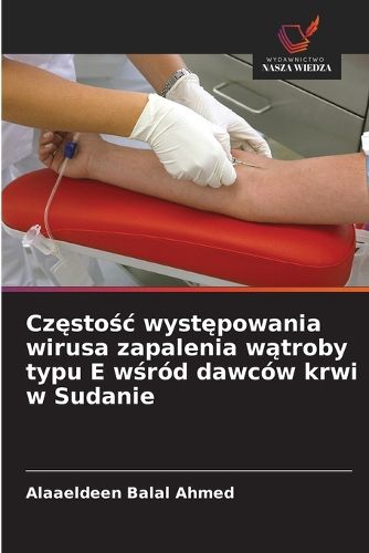 Cover image for Częstośc występowania wirusa zapalenia wątroby typu E wśrod dawcow krwi w Sudanie