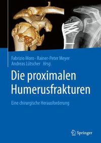 Cover image for Die Proximalen Humerusfrakturen: Eine Chirurgische Herausforderung