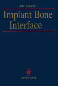 Cover image for Implant Bone Interface