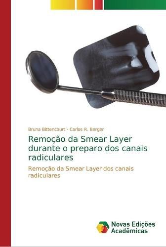 Remocao da Smear Layer durante o preparo dos canais radiculares