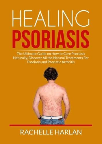 Cover image for Healing Psoriasis: The Ultimate Guide on How to Cure Psoriasis Naturally, Discover All the Natural Treatments For Psoriasis and Psoriatic Arthritis