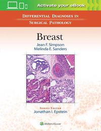 Cover image for Differential Diagnoses in Surgical Pathology: Breast