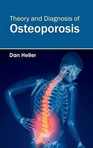 Cover image for Theory and Diagnosis of Osteoporosis