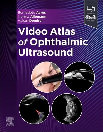 Cover image for Video Atlas of Ophthalmic Ultrasound