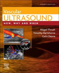 Cover image for Vascular Ultrasound: How, Why and When