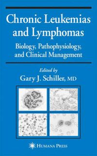 Cover image for Chronic Leukemias and Lymphomas: Biology, Pathophysiology, and Clinical Management