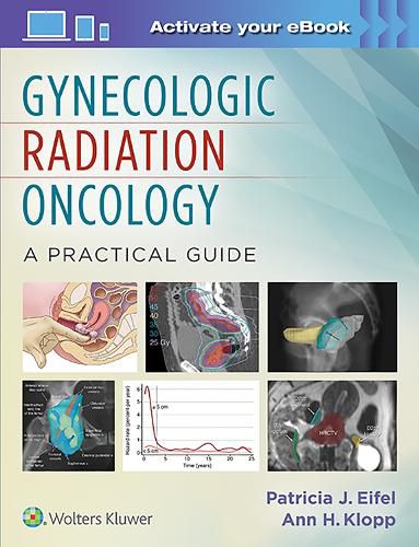 Cover image for Gynecologic Radiation Oncology: A Practical Guide