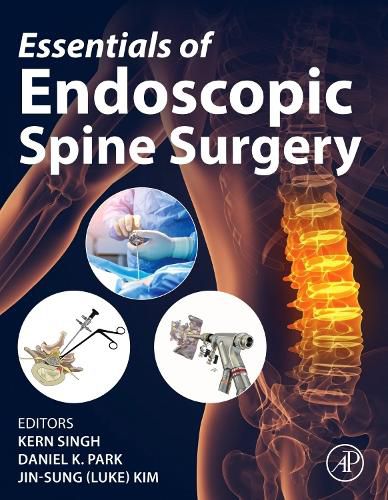 Cover image for Essentials of Endoscopic Spine Surgery