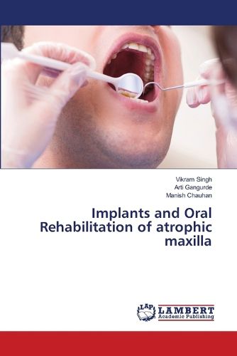 Cover image for Implants and Oral Rehabilitation of atrophic maxilla