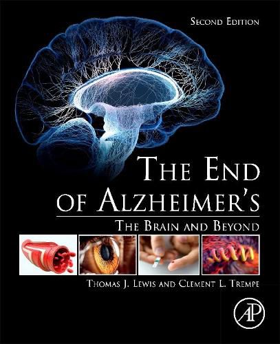 The End of Alzheimer's: The Brain and Beyond