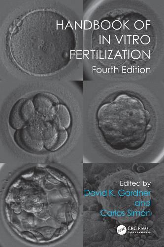 Cover image for Handbook of In Vitro Fertilization