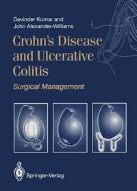 Cover image for Crohn's Disease and Ulcerative Colitis: Surgical Management