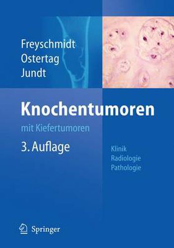 Cover image for Knochentumoren mit Kiefertumoren: Klinik - Radiologie - Pathologie