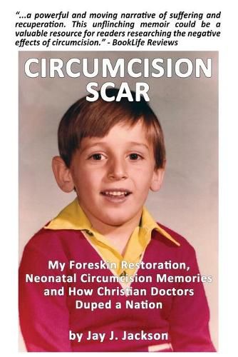 Circumcision Scar: My Foreskin Restoration, Neonatal Circumcision Memories and How Christian Doctors Duped a Nation