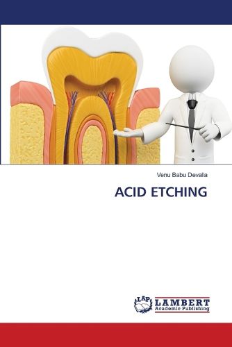 Cover image for Acid Etching