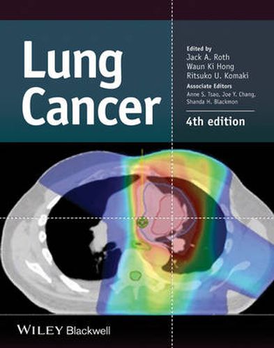 Cover image for Lung Cancer