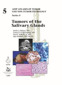 Cover image for Tumors of the Salivary Glands