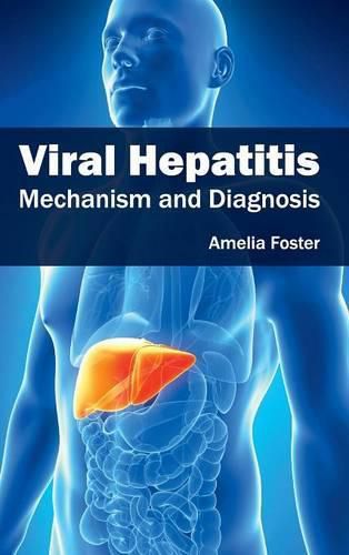 Cover image for Viral Hepatitis: Mechanism and Diagnosis