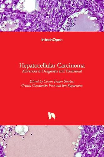 Cover image for Hepatocellular Carcinoma: Advances in Diagnosis and Treatment