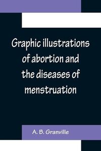 Cover image for Graphic illustrations of abortion and the diseases of menstruation; Consisting of Twelve Plates from Drawings Engraved on Stone, and Coloured by Mr. J. Perry, and Two Copper-plates from the Philosophical Transactions, Coloured by the Same Artist. the Whole