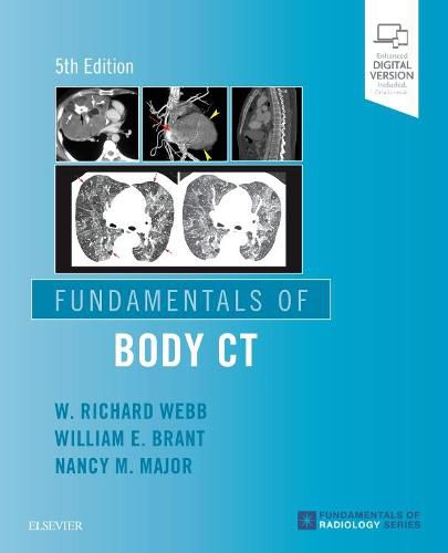 Cover image for Fundamentals of Body CT