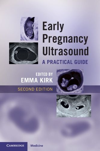 Cover image for Early Pregnancy Ultrasound