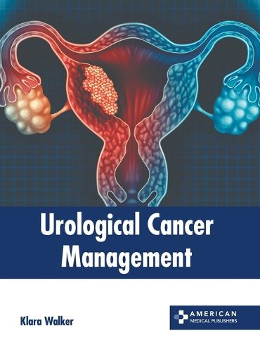 Cover image for Urological Cancer Management