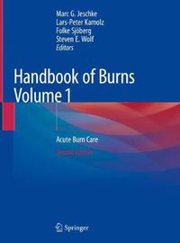 Cover image for Handbook of Burns Volume 1: Acute Burn Care