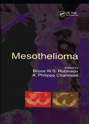 Mesothelioma