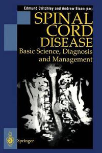 Cover image for Spinal Cord Disease: Basic Science, Diagnosis and Management